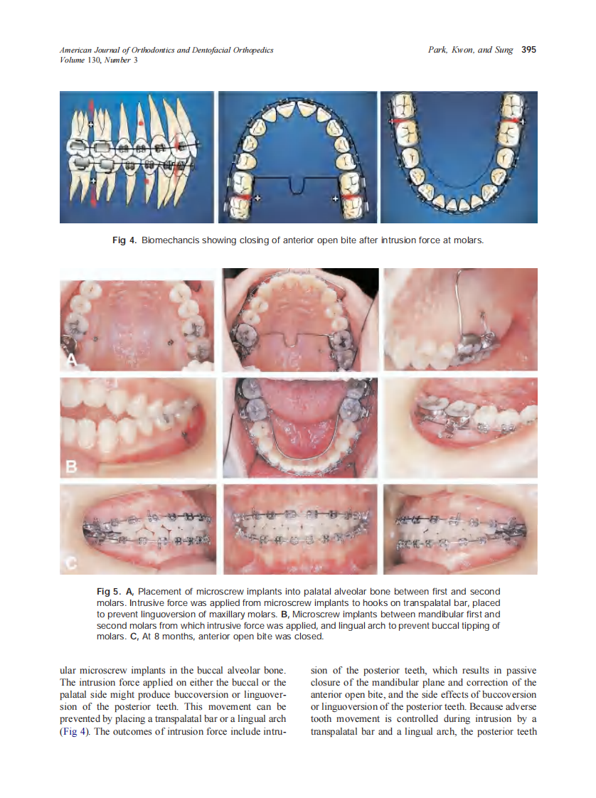 2006_130_3_391_402_Park.pdf 第5页