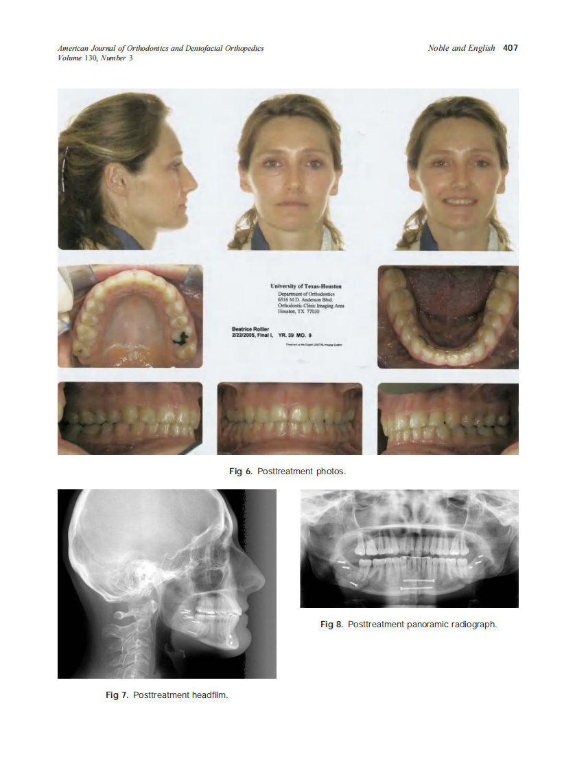 2006_130_3_403_408_Noble.pdf 第5页