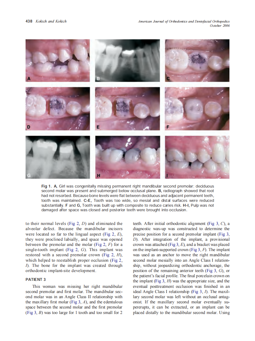 2006_130_4_437_444_Kokich.pdf 第2页
