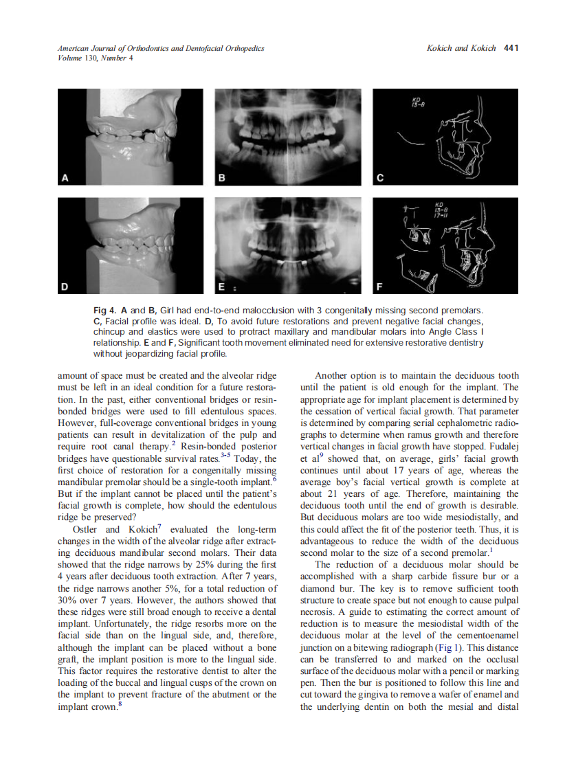 2006_130_4_437_444_Kokich.pdf 第5页