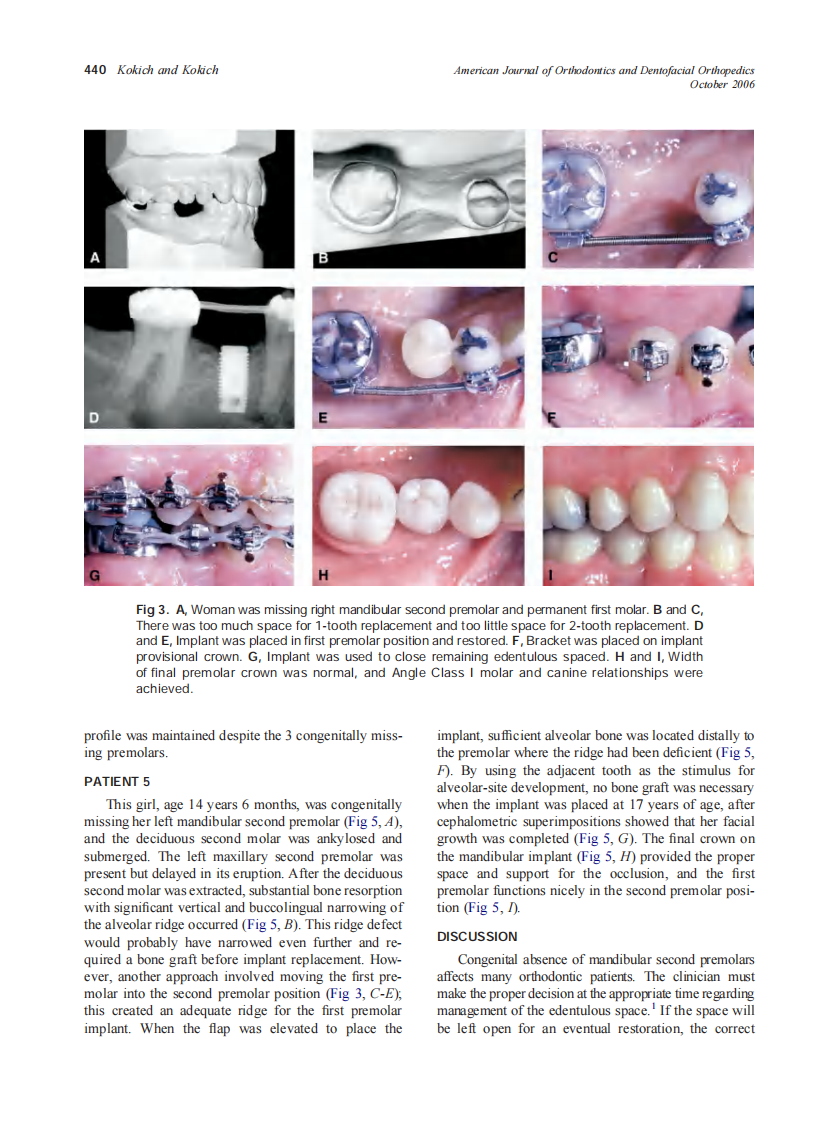 2006_130_4_437_444_Kokich.pdf 第4页