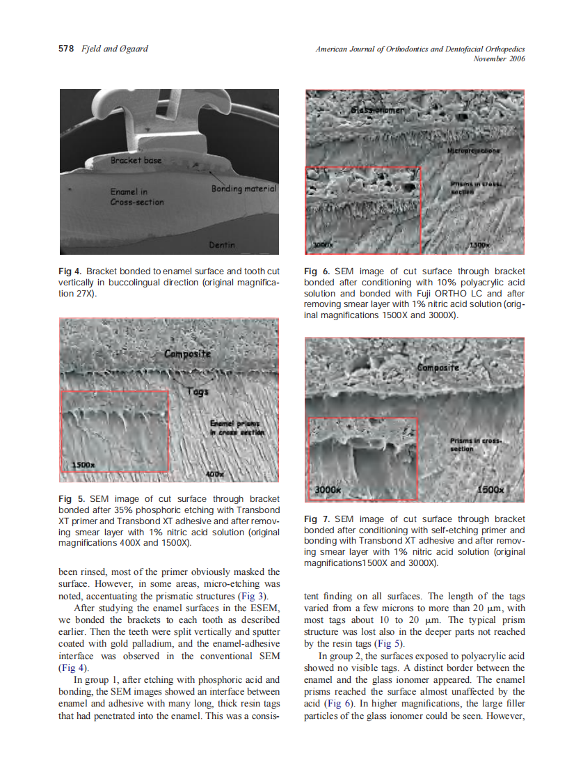 2006_130_5_575_581_Fjeld.pdf 第4页