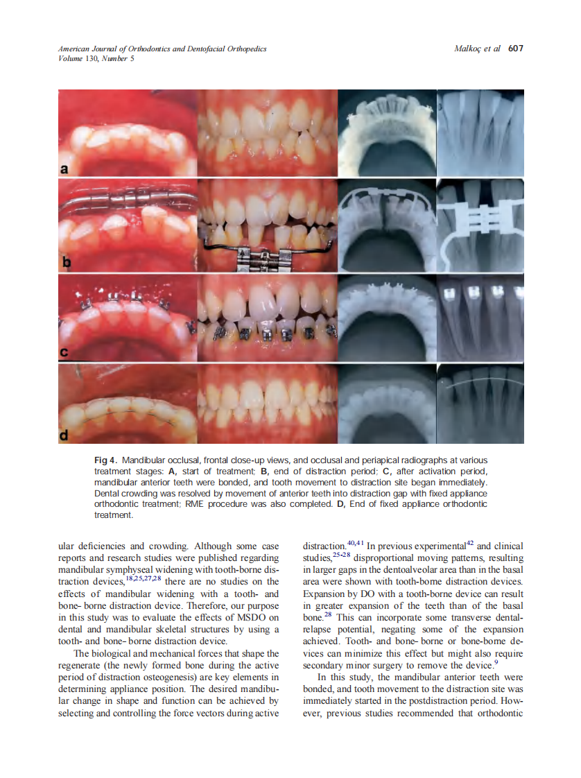 2006_130_5_603_611_Malkoc.pdf 第5页