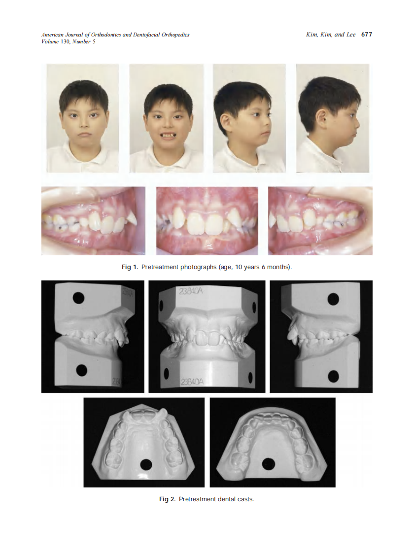 2006_130_5_676_685_Kim.pdf 第2页
