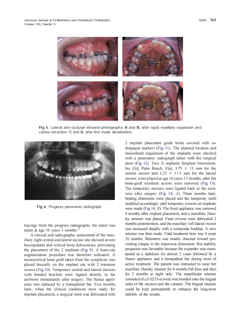 2006_130_6_759_770_Sabri.pdf 第5页