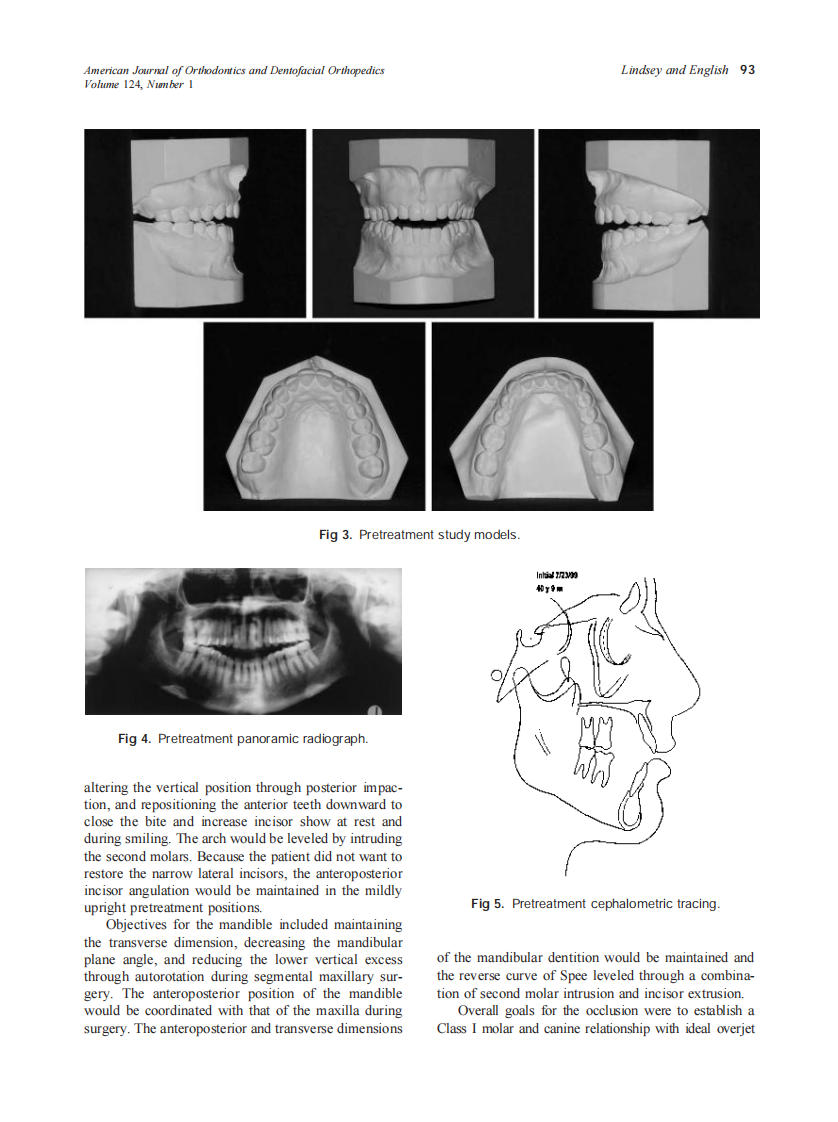 2003_124_1_91_98_Lindsey.pdf 第3页
