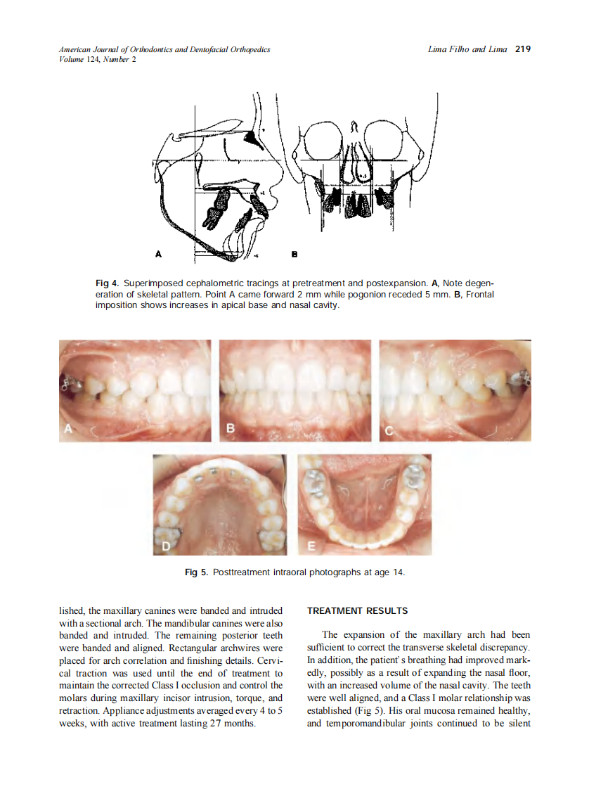 2003_124_2_216_224_Filho.pdf 第4页