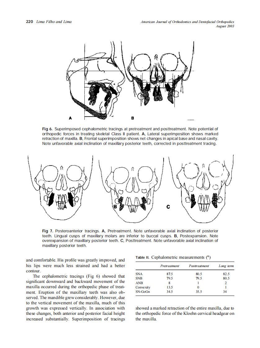 2003_124_2_216_224_Filho.pdf 第5页