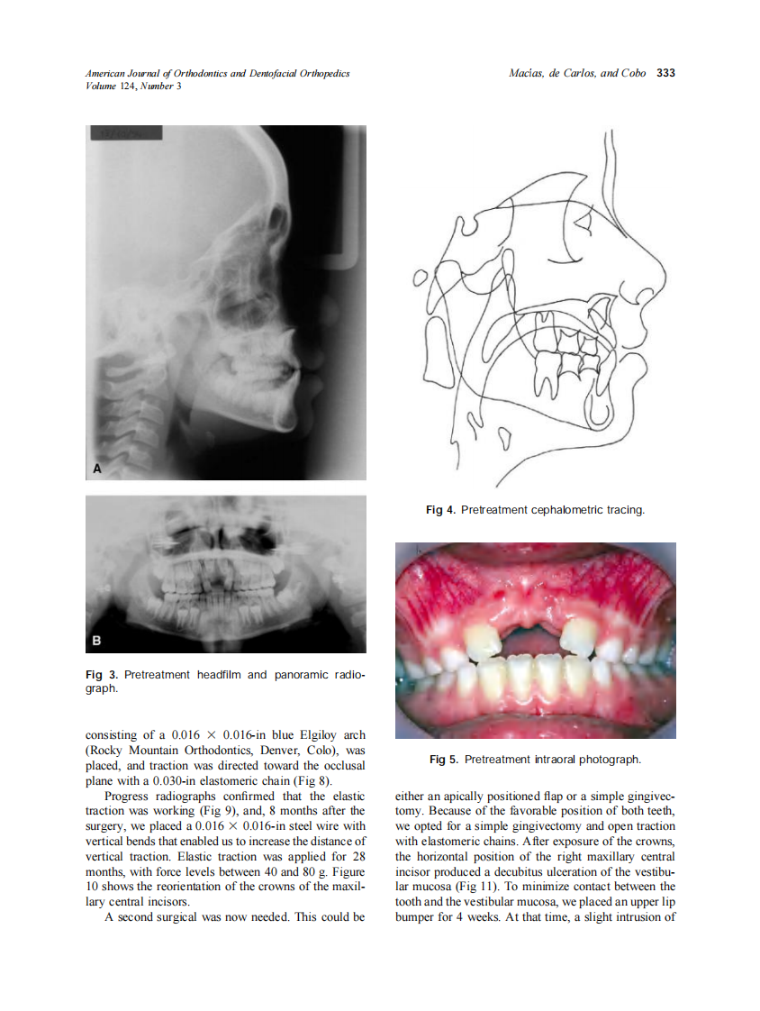 2003_124_3_331_338_Macias.pdf 第3页
