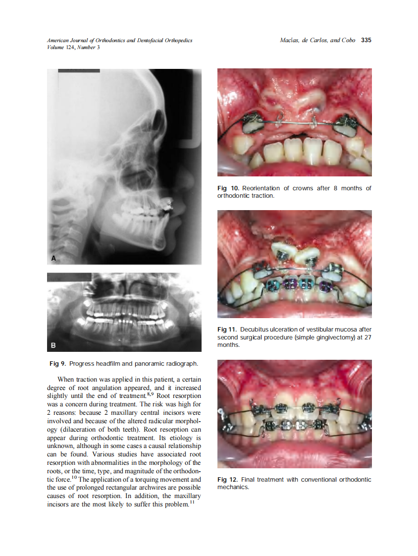 2003_124_3_331_338_Macias.pdf 第5页