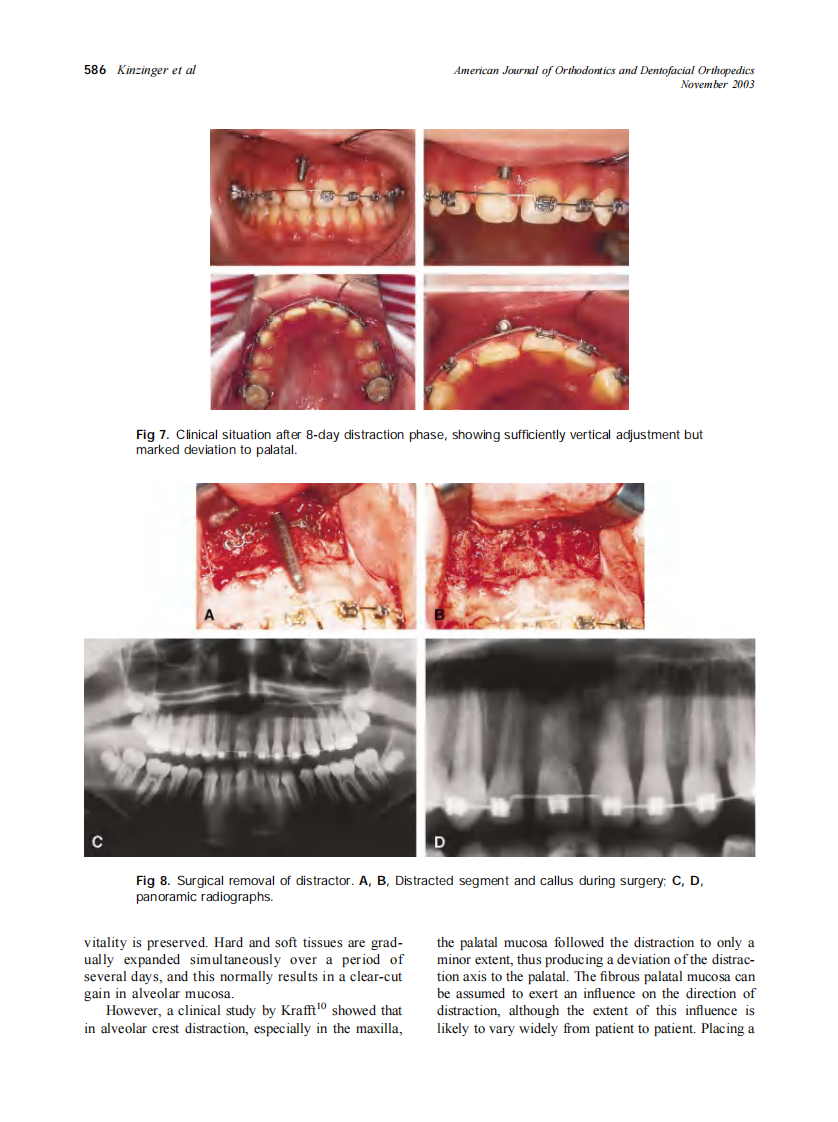 2003_124_5_582_590_Kinzinger.pdf 第5页