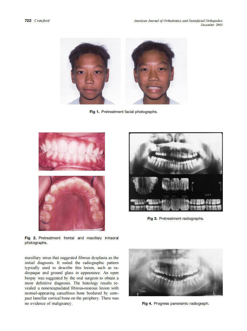 2003_124_6_721_724_Crawford.pdf 第2页