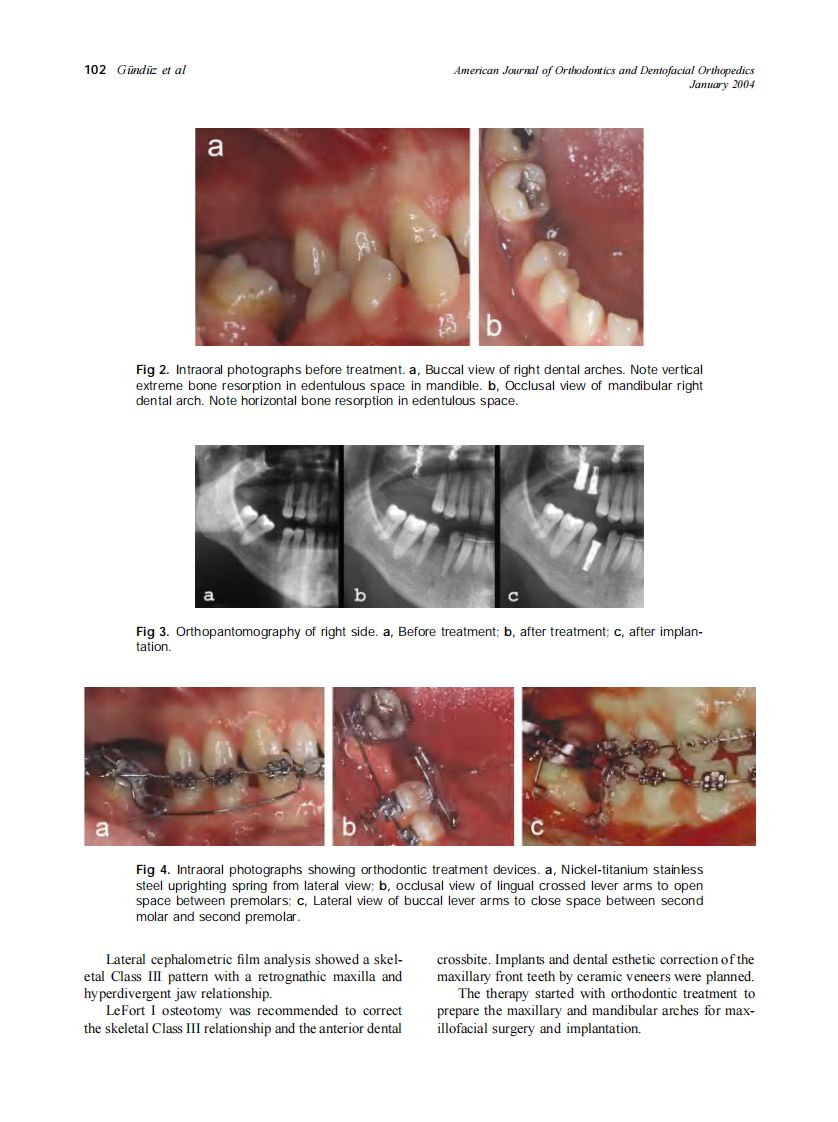 2004_125_1_100_106_Gunduz.pdf 第3页