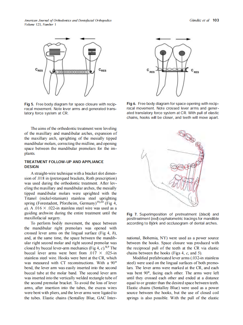 2004_125_1_100_106_Gunduz.pdf 第4页