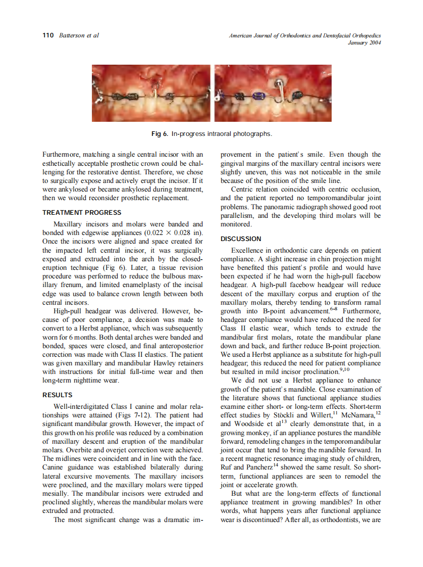 2004_125_1_107_114_Batterson.pdf 第4页