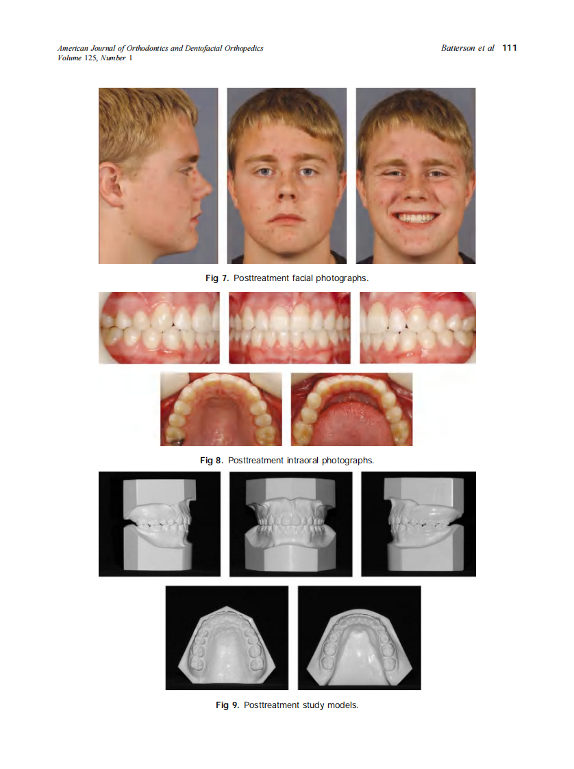 2004_125_1_107_114_Batterson.pdf 第5页