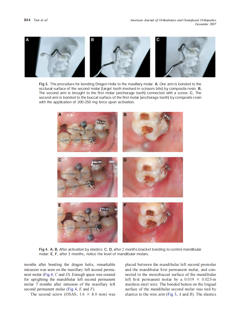 2007_132_6_842_847_Yun.pdf 第3页