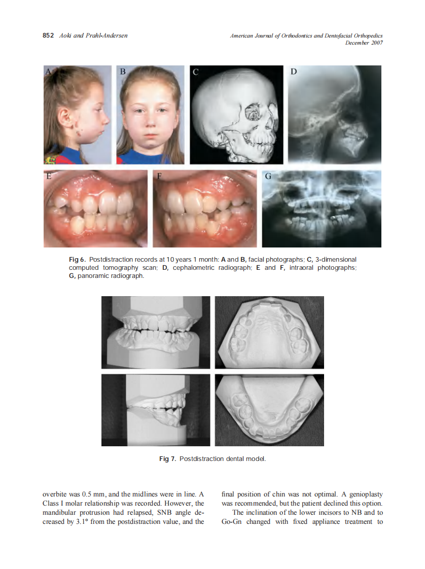 2007_132_6_848_855_Aoki.pdf 第5页