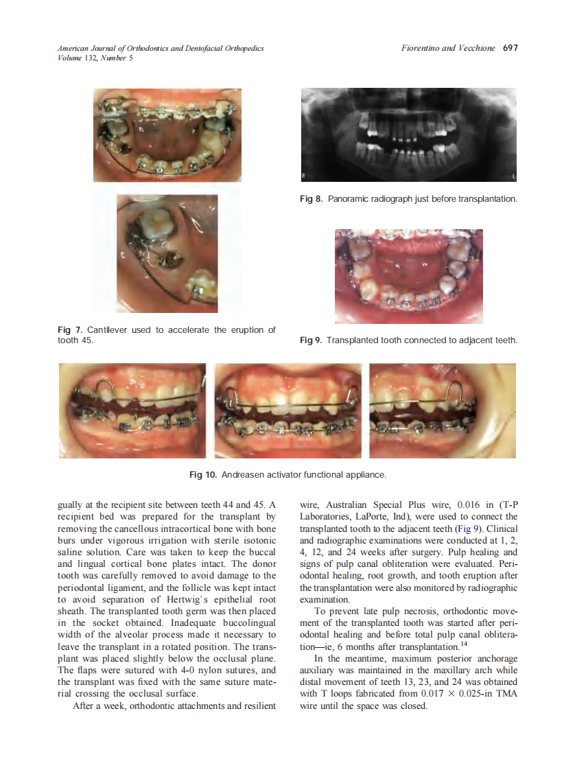 2007_132_5_693_703_Fiorentino.pdf 第5页