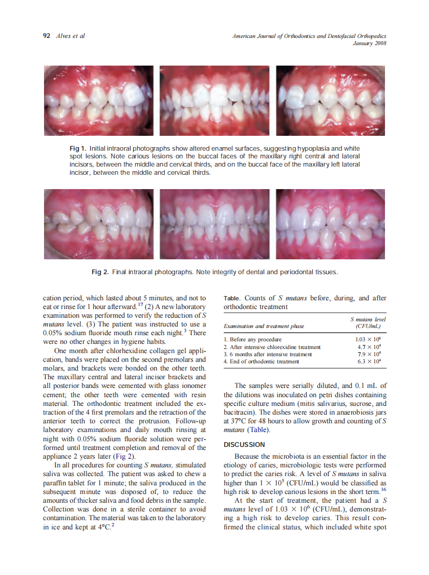 2008_133_1_91_94_Alves.pdf 第2页