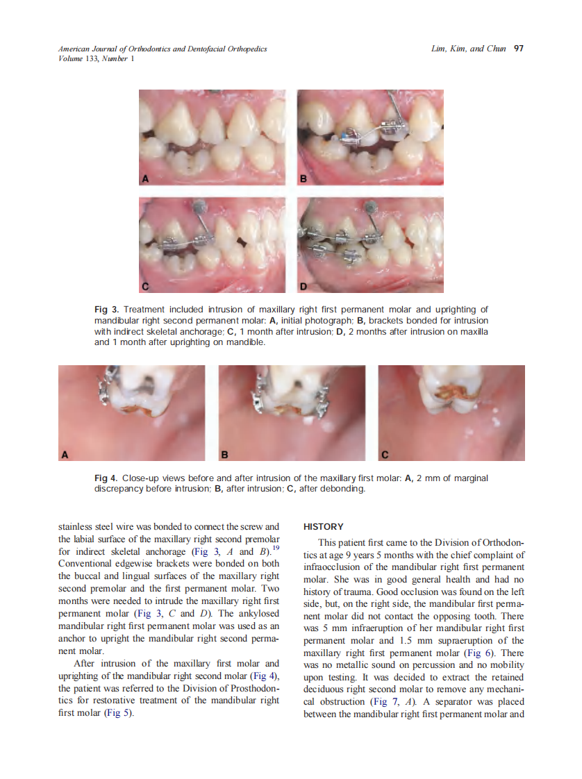 2008_133_1_95_101_Lim.pdf 第3页