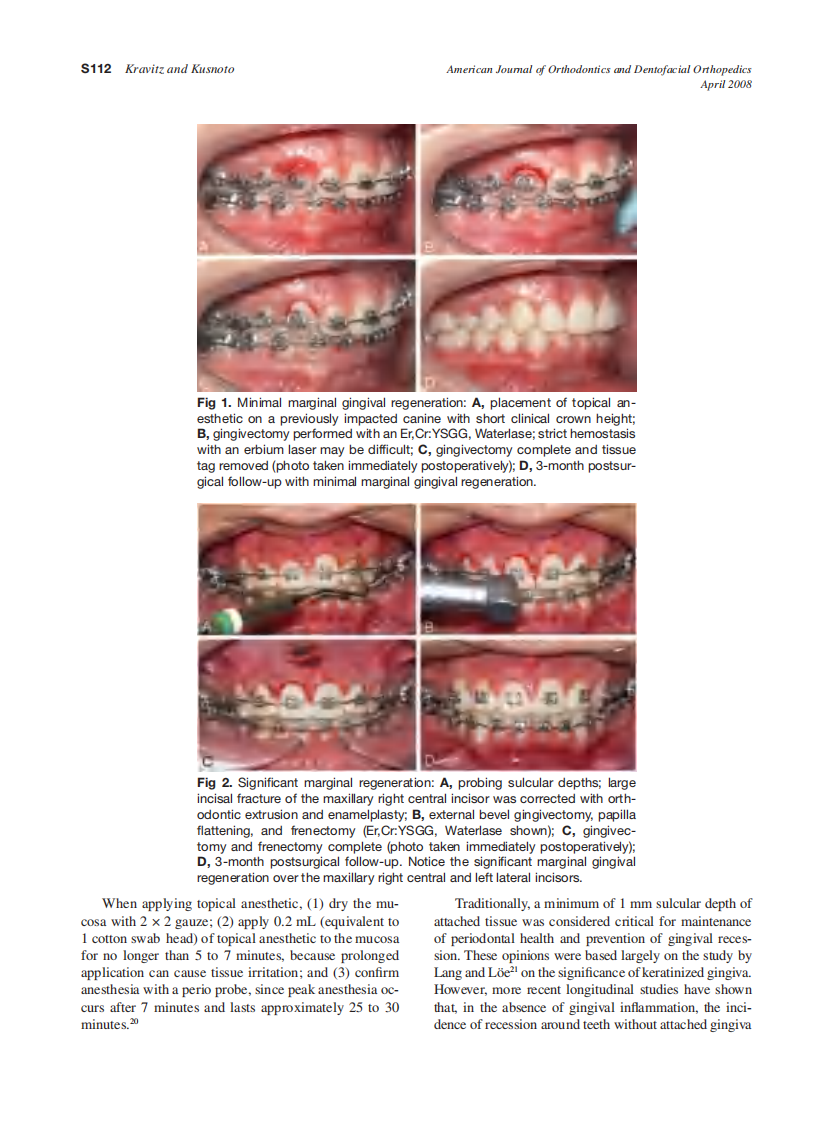 2008_133_4-Suppl-1_S110_S114_Kravitz.pdf 第3页