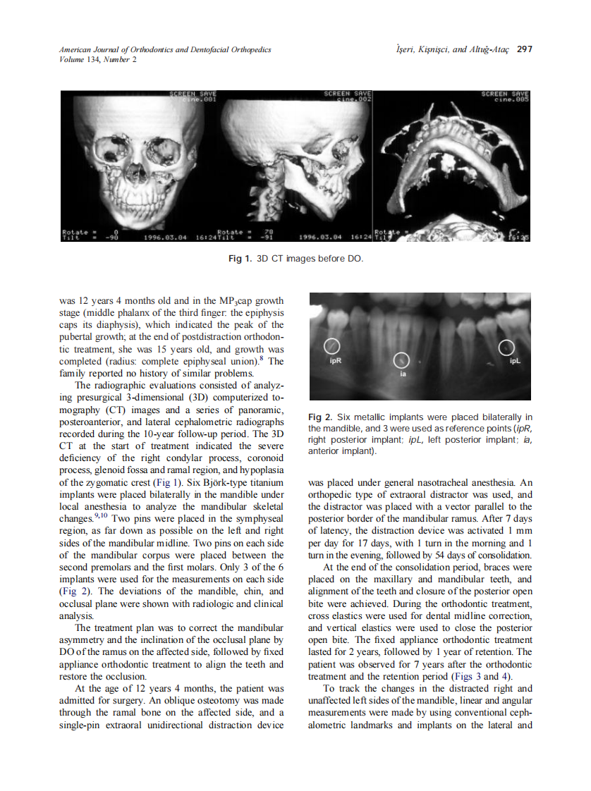 2008_134_2_296_304_Iseri.pdf 第2页