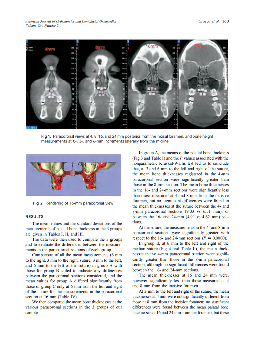 2008_134_3_361_369_Gracco.pdf 第3页