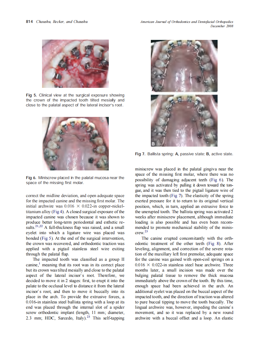 2008_134_6_811_819_Chaushu.pdf 第4页