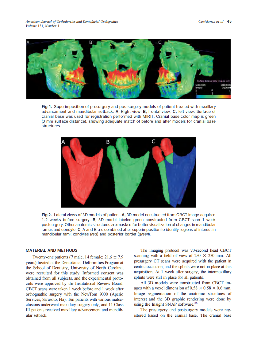 2007_131_1_44_50_Cevidanes.pdf 第2页