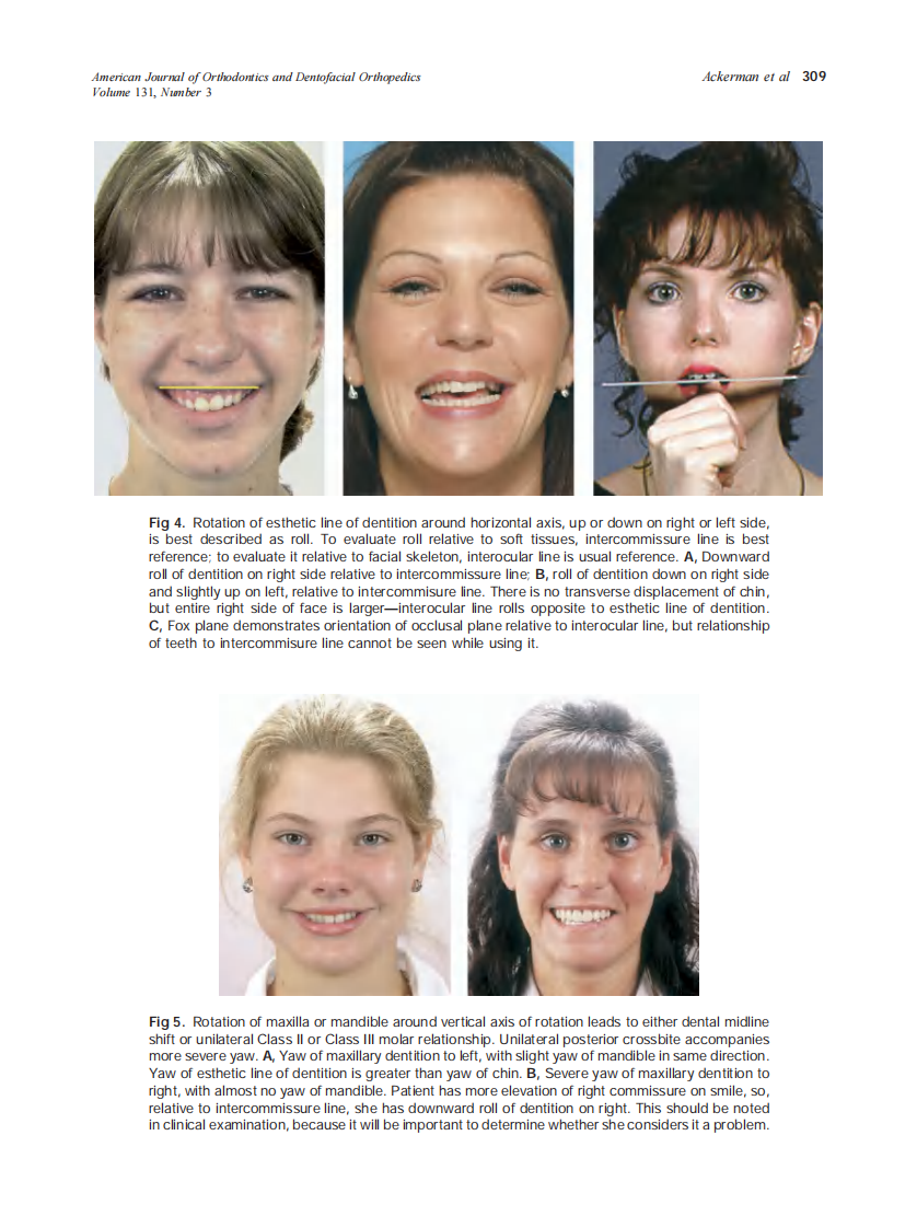 2007_131_3_305_310_Ackerman.pdf 第5页