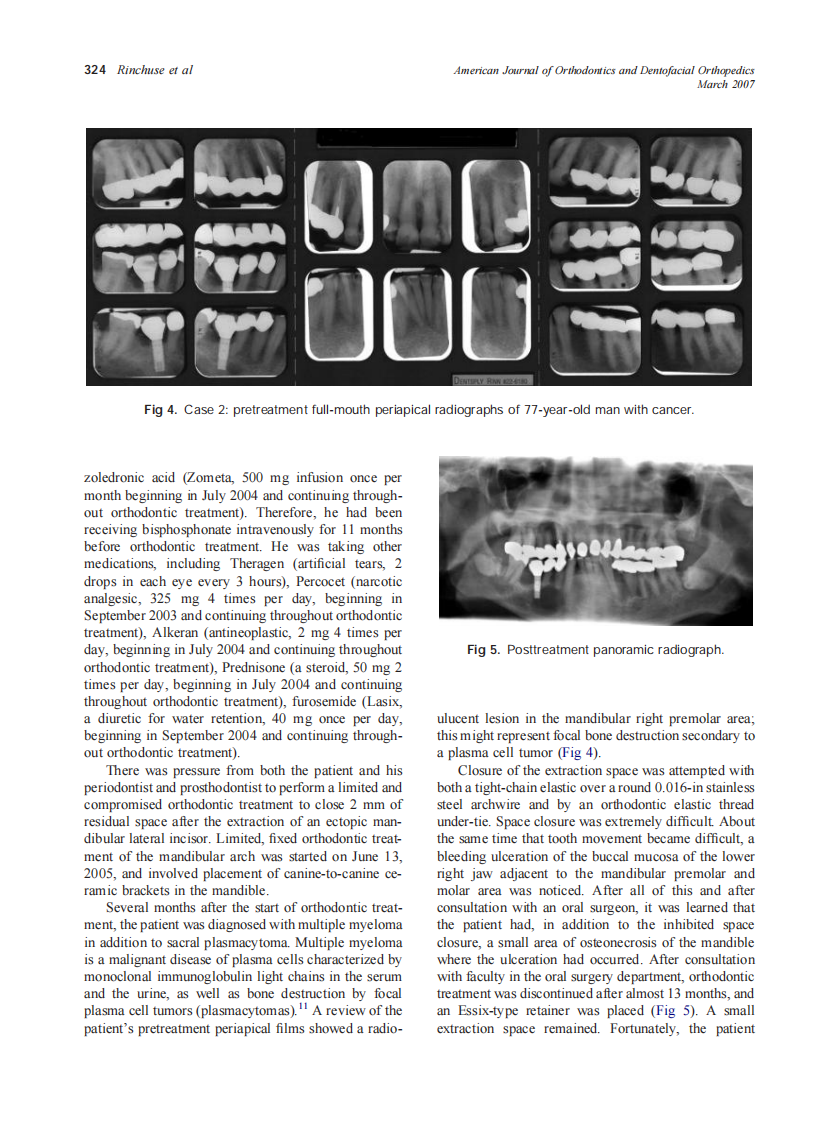 2007_131_3_321_326_Rinchuse.pdf 第4页