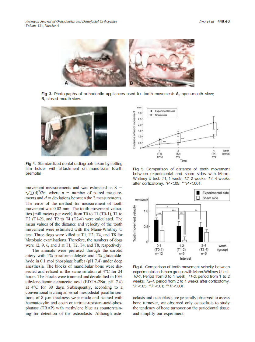 2007_131_4_448.e1_448.e8_Iino.pdf 第3页