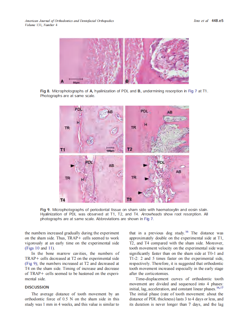 2007_131_4_448.e1_448.e8_Iino.pdf 第5页