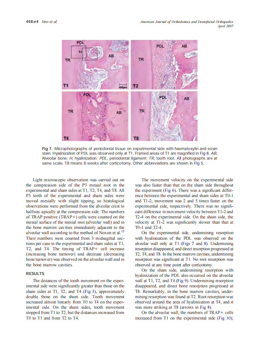 2007_131_4_448.e1_448.e8_Iino.pdf 第4页
