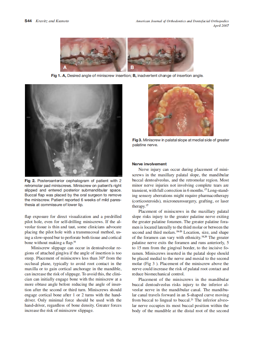 2007_131_4-Suppl-1_S43_S51_Kravitz.pdf 第2页