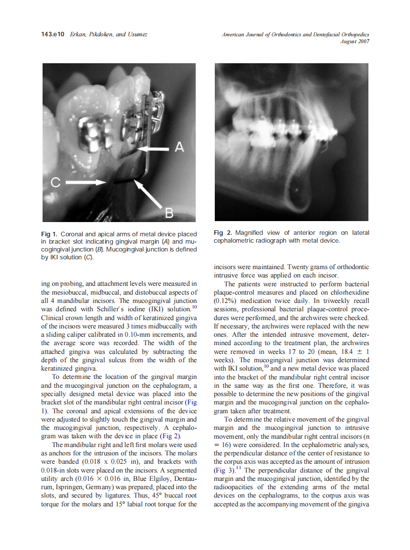 2007_132_2_143.e9_143.e13_Erkan.pdf 第2页