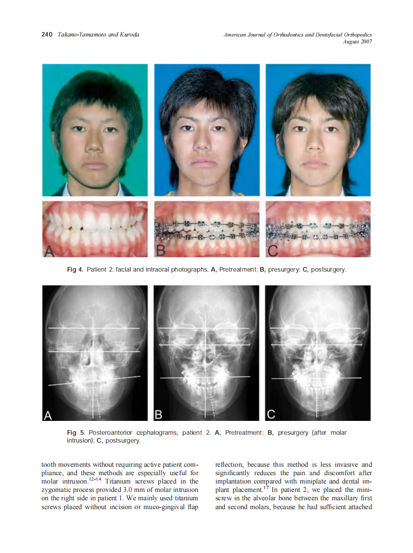 2007_132_2_237_242_Takano-Yamamoto.pdf 第4页