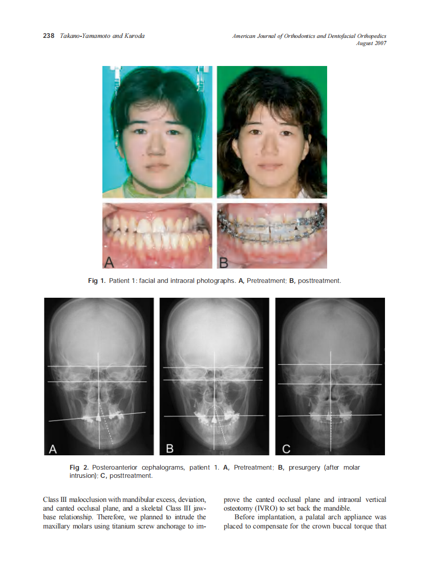 2007_132_2_237_242_Takano-Yamamoto.pdf 第2页