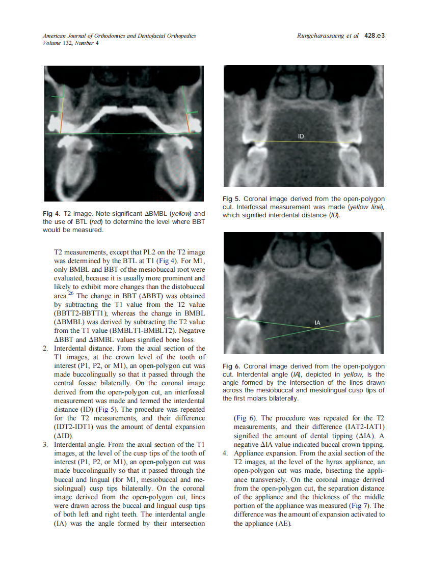 2007_132_4_428.e1_428.e8_Rungcharassaeng.pdf 第3页