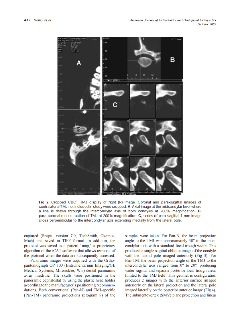 2007_132_4_429_438_Honey.pdf 第4页
