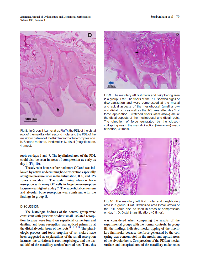 Sombuntham_Early-tooth-movement-with-a-clear-plastic-appliance-in-rats_2009.pdf 第5页