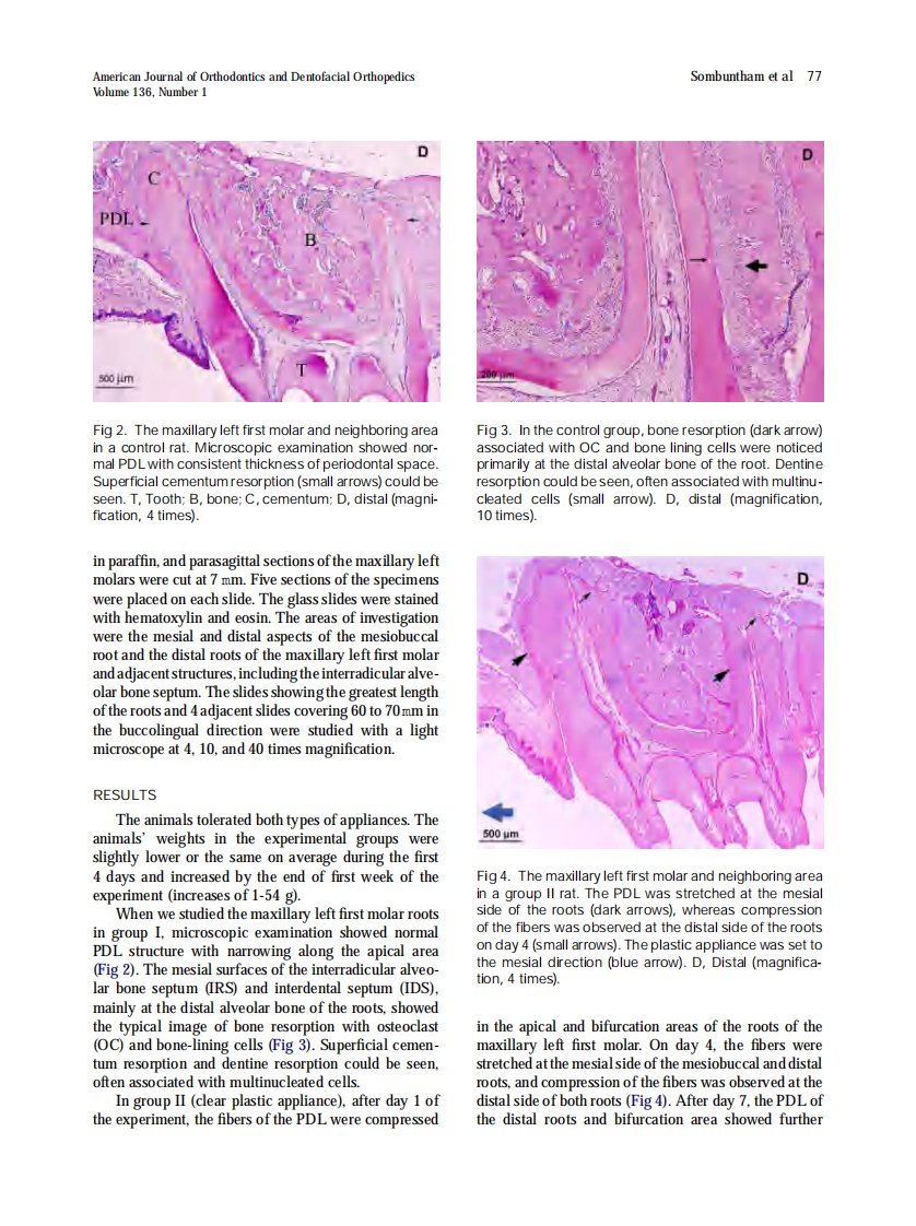 Sombuntham_Early-tooth-movement-with-a-clear-plastic-appliance-in-rats_2009.pdf 第3页
