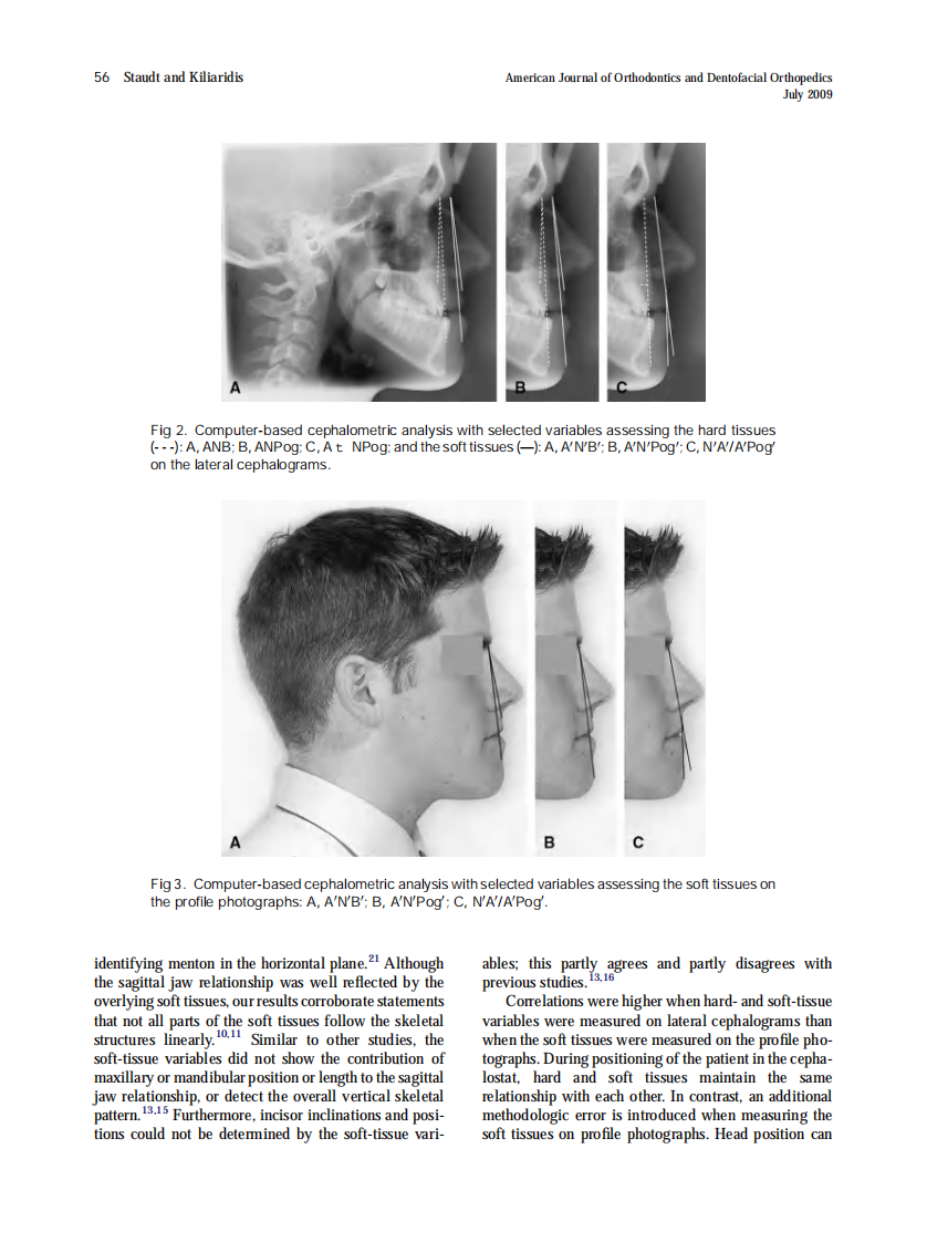 Staudt_A-nonradiographic-approach-to-detect-Class-III-skeletal-discrepancies_2009.pdf 第5页