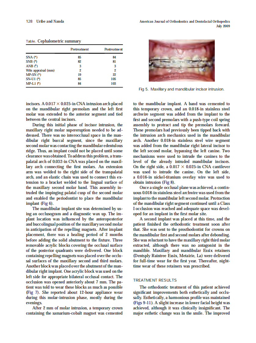 Uribe_Intramaxillary-and-intermaxillary-absolute-anchorage-with-an-endosseous-dental-implant-and-rare-earth-magnets_2009.pdf 第5页