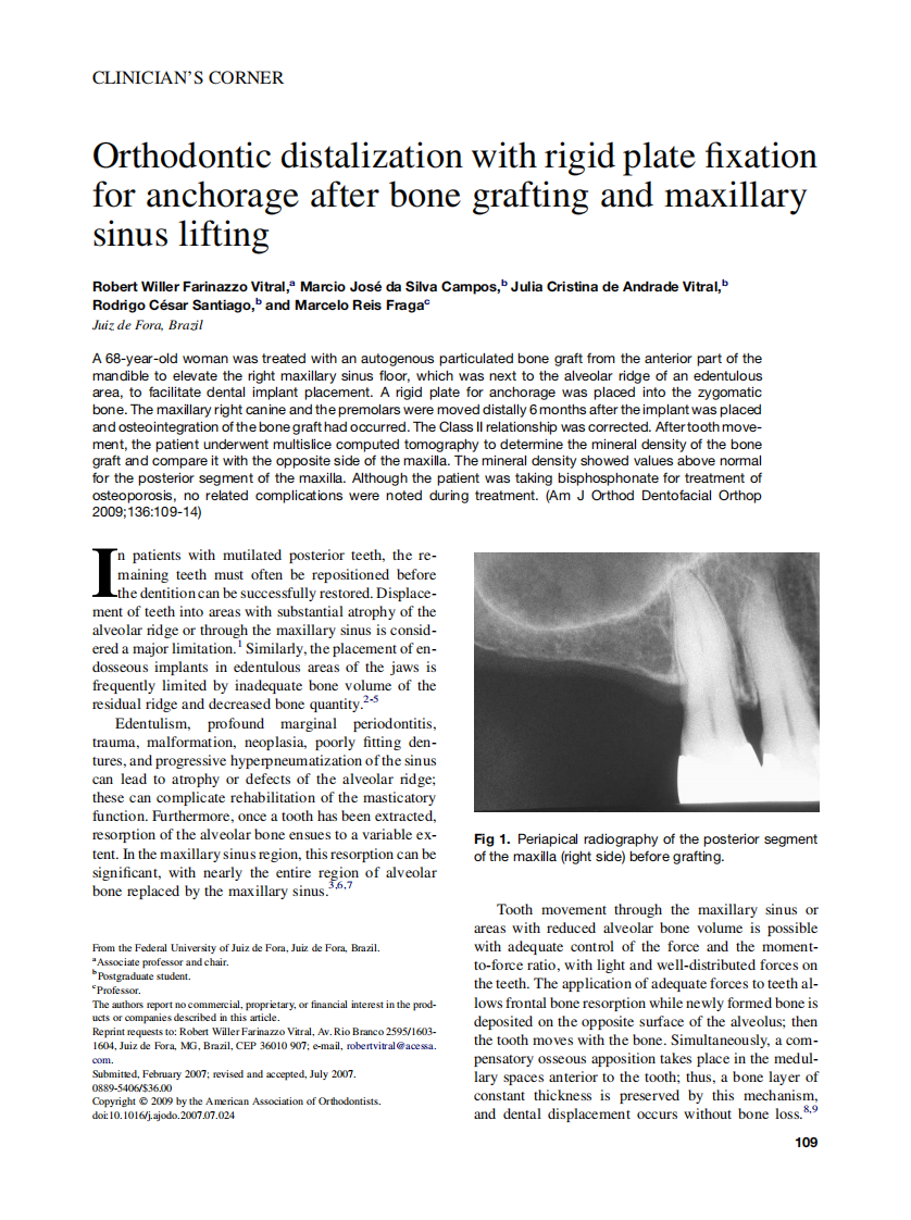 Vitral_Orthodontic-distalization-with-rigid-plate-fixation-for-anchorage-after-bone-grafting-and-maxillary-sinus-lifting_2009.pdf 第1页