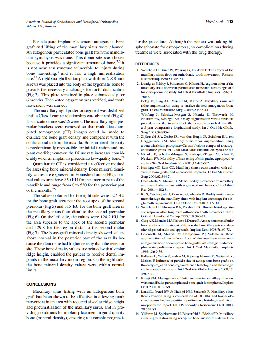 Vitral_Orthodontic-distalization-with-rigid-plate-fixation-for-anchorage-after-bone-grafting-and-maxillary-sinus-lifting_2009.pdf 第5页