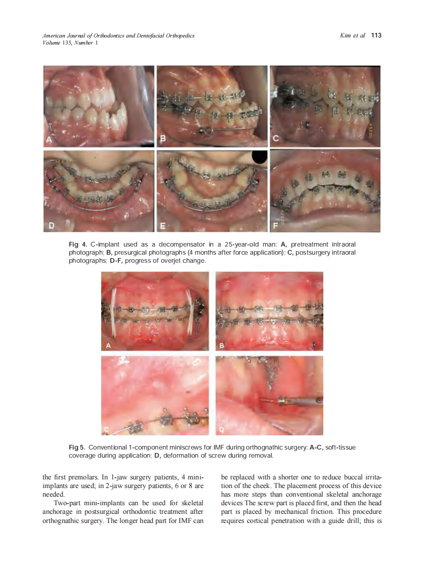 2009_135_1_110_117_Kim.pdf 第4页