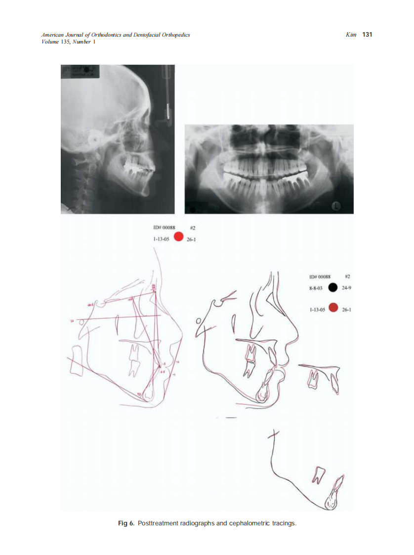 2009_135_1_127_132_Kim.pdf 第5页