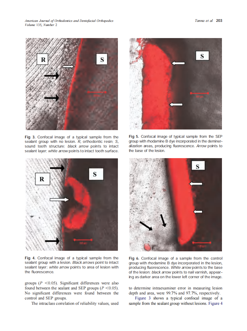 2009_135_2_199_205_Tanna.pdf 第5页